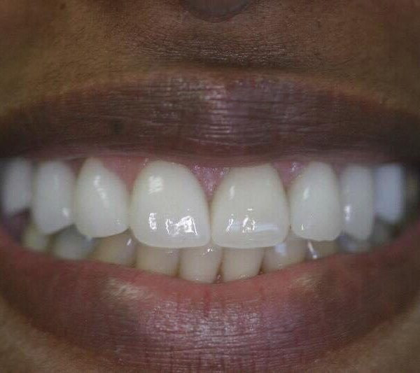 WhatsApp Image 2026 05 07 at 17 34 09 2 600x533